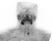 parathyrscan.gif